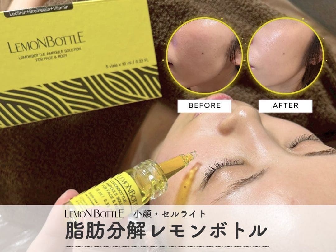 即日対応 脂肪溶解LEMONBOTTLE(レモンボトル) 10ml×1本※正規品