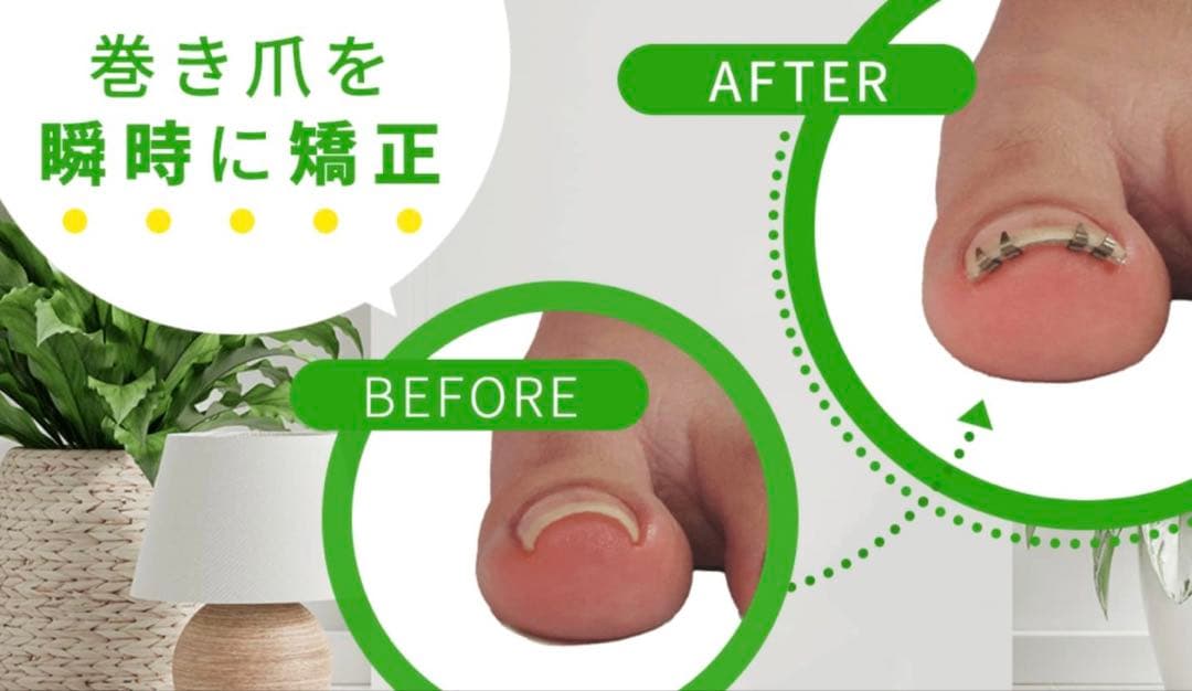 まき爪リフト　4個セット【正規品】